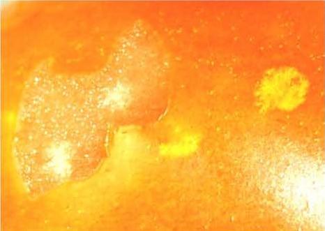 Spongy white area under star‐burst feeding