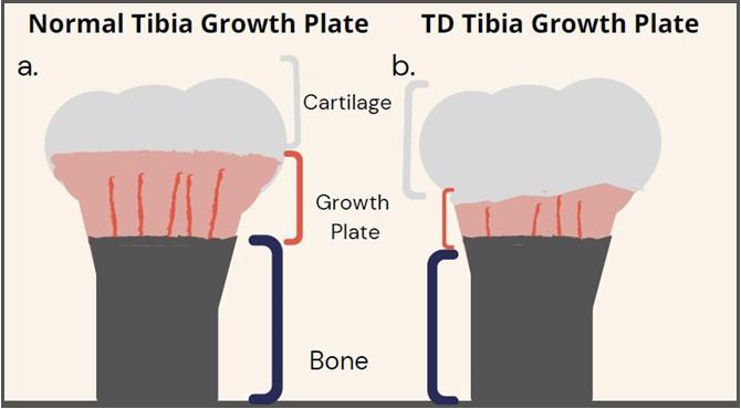 A. Normal Tibia Growth plate (Left) and B. TD Tibia Growth Plate (Right)