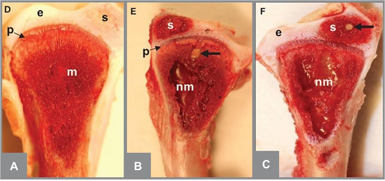 Normal appearance of the tibial head (A). Bacterial infection has destroyed a portion of the growth plate (B, C). Thick arrows point to bacterial colonies. Source: Wideman and Prisby