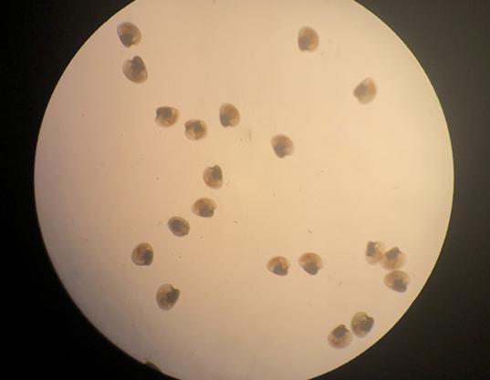 Microscopic image of oyster larvae