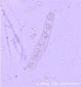 Figure 2. Microscope image of P. maydis ascus containing ascospores, which are blown and splashed to infect new corn tissue.