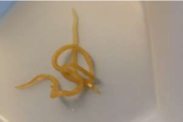A long, pale yellow, worm‑like internal parasite lying coiled on in a pitri dish, showing a smooth body and tapered ends.